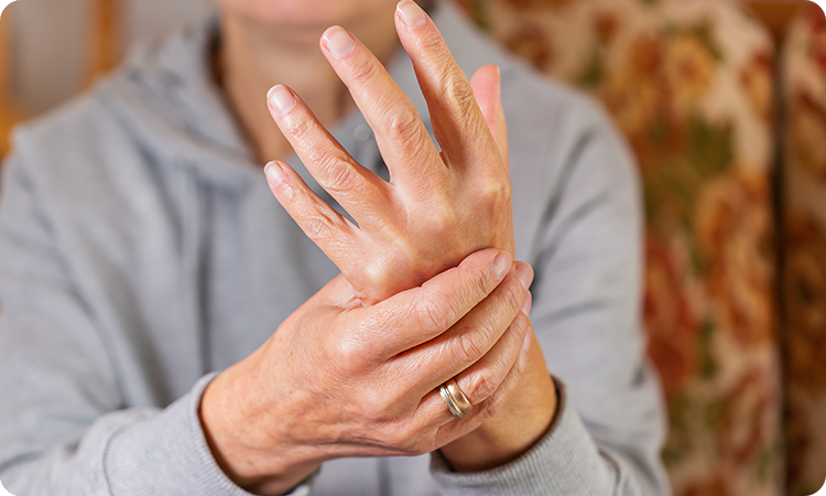 Rheumatoid arthritis (Vata Rakta)